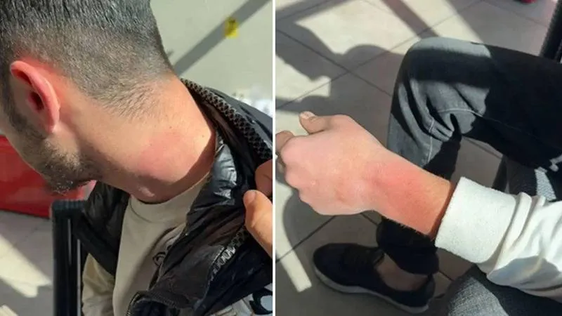 Ters kelepçeyle ormana götürüldüler, biber gazıyla bayıltıldılar; işkence iddiası jandarma soruşturmasında